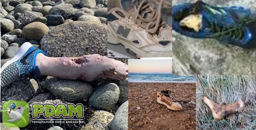 Potongan Kaki di Sepatu Sebuah Misteri Yang Belum Terpecahkan